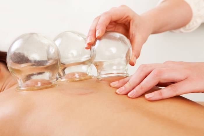 Wet Cupping